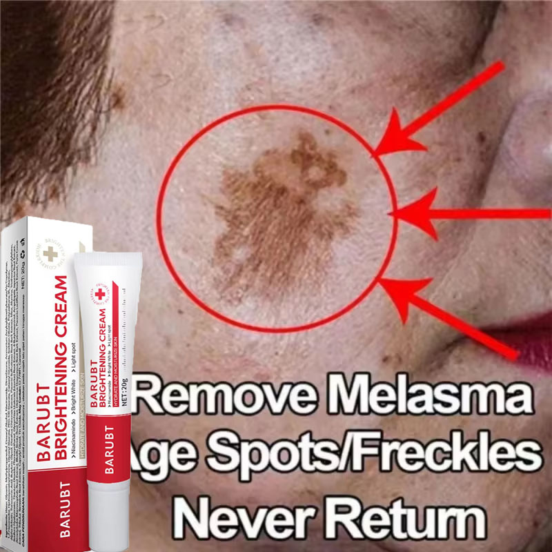 Vitamin C Serum Face - ครีมไวท์เทนนิ่งกำจัดจุดด่างดำที่มีประสิทธิภาพ ปรับผิวให้กระจ่างใสอย่างรวดเร็ว ขจัดเมลานิน จุดด่างดำ ฝ้า กระ