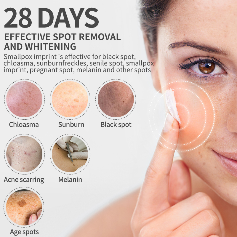 Dimollaure Whitening Freckle C - Beauty Glazed Makeup บทวิจารณ์และราคา