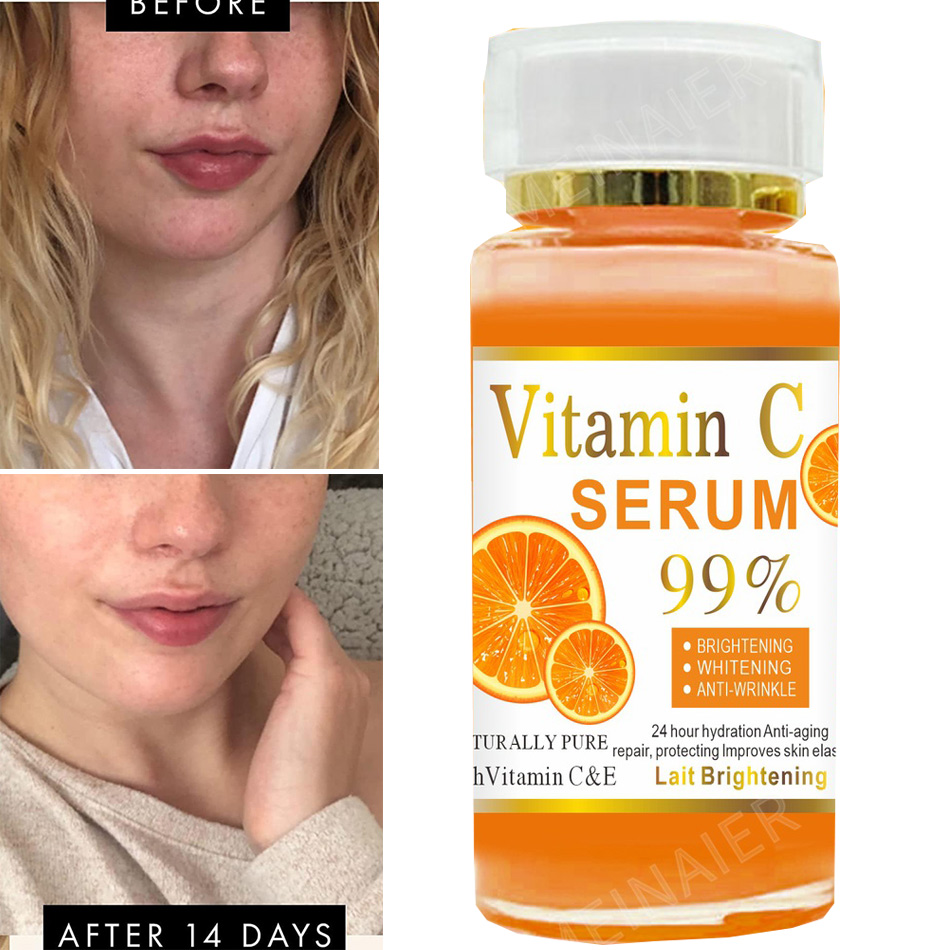เซรั่มวิตามินซี120มล. ต่อต้านร - Vitamin C Serum Face บทวิจารณ์และราคา