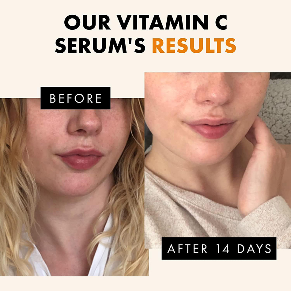 เซรั่มวิตามินซี120มล. ต่อต้านร - Vitamin C Serum Face บทวิจารณ์และราคา